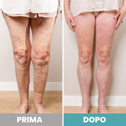 RinovaX™ – Elektrisk fotmassageapparat